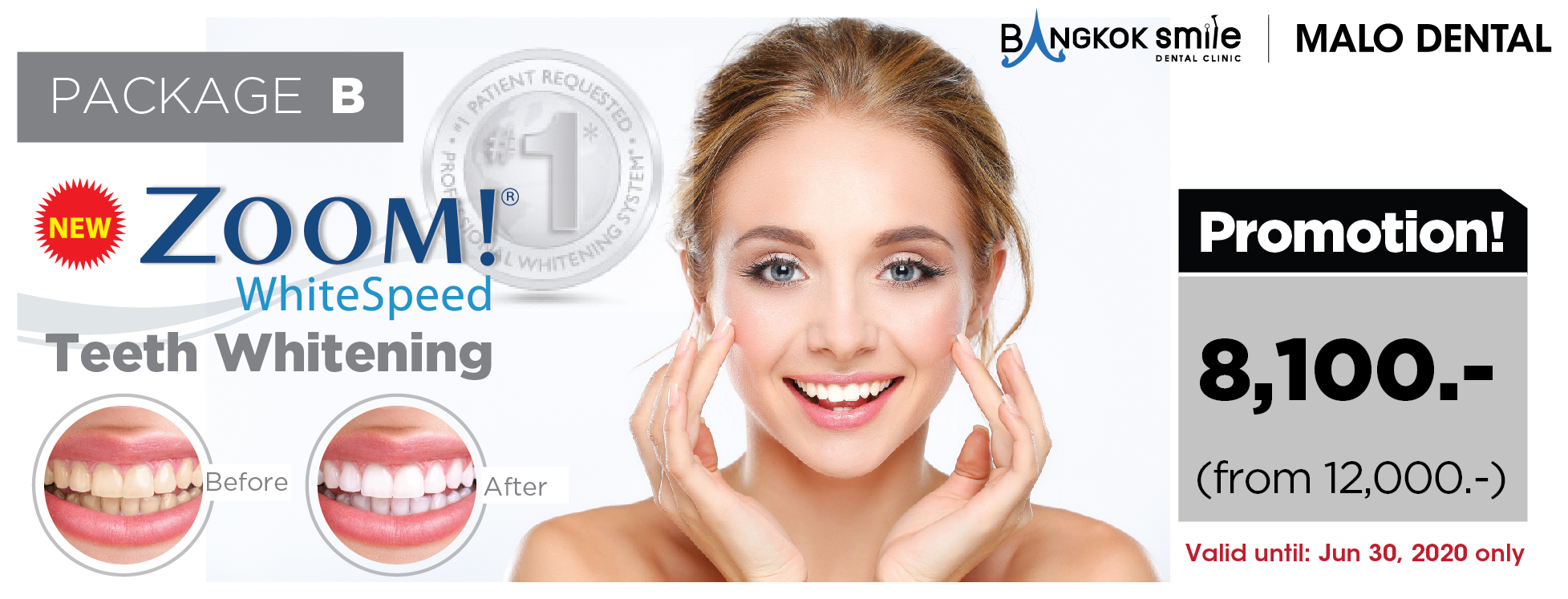 Prices Bangkok Dental, Dentist Clinic by Bangkok Smile Dental.