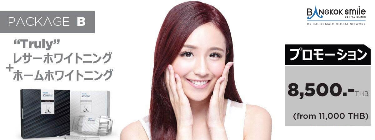 プロモーション 歯ホワイトニング