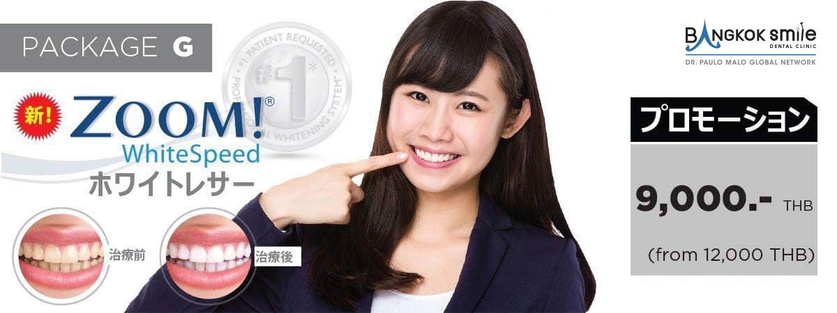 プロモーション 歯ホワイトニング
