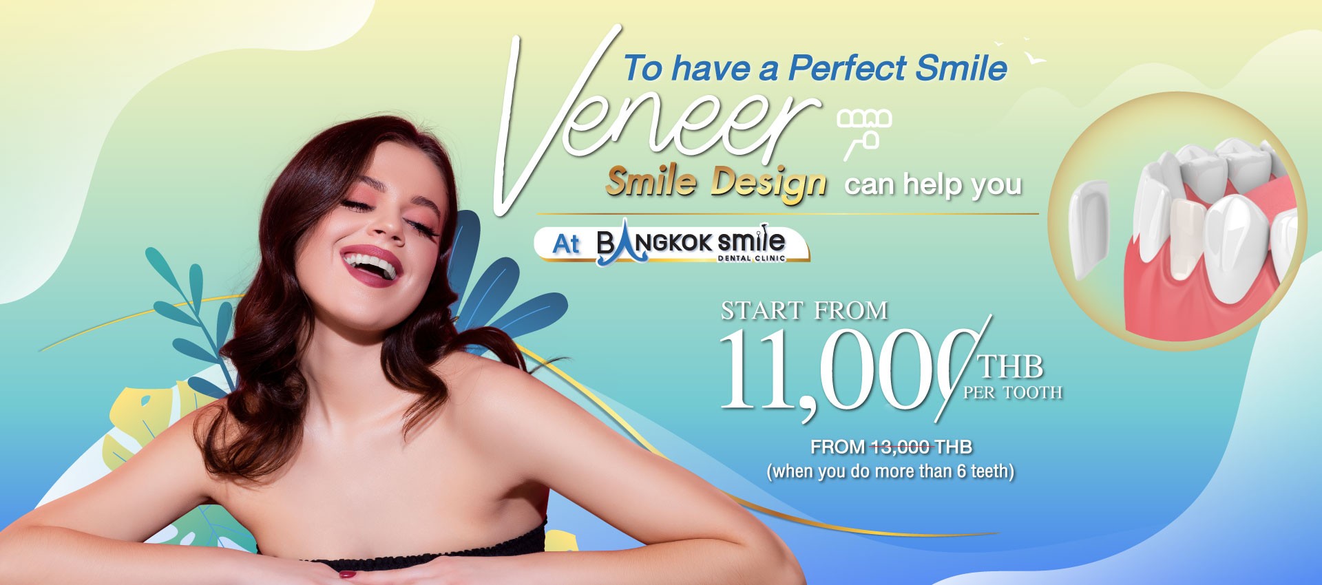 Digital Veneers By Bangkok Smile Dental Clinic