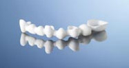 Procera® Bridge Zirconia 