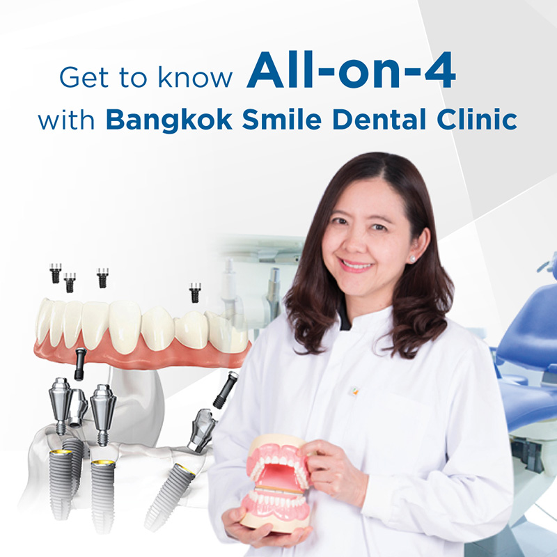 bangkok dental, dental clinic, dental bridge, dental clinic, dental cosmetic, dental crown, dental veneer, dentist, implant, implants, invisalign, laser whitening, teeth whitening, tooth whitening, bangkok, thailand