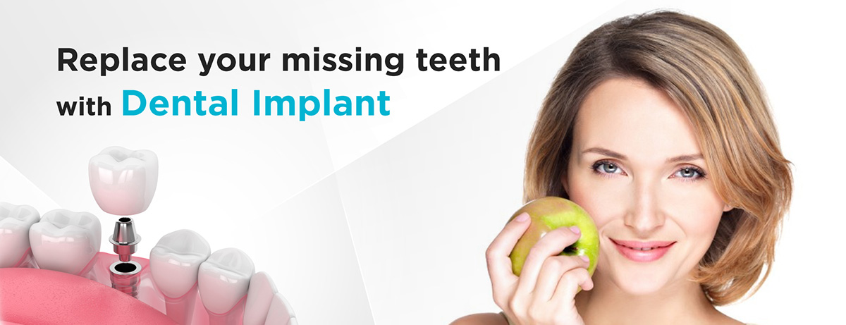 Missing teeth? Fix them with Dental Implant