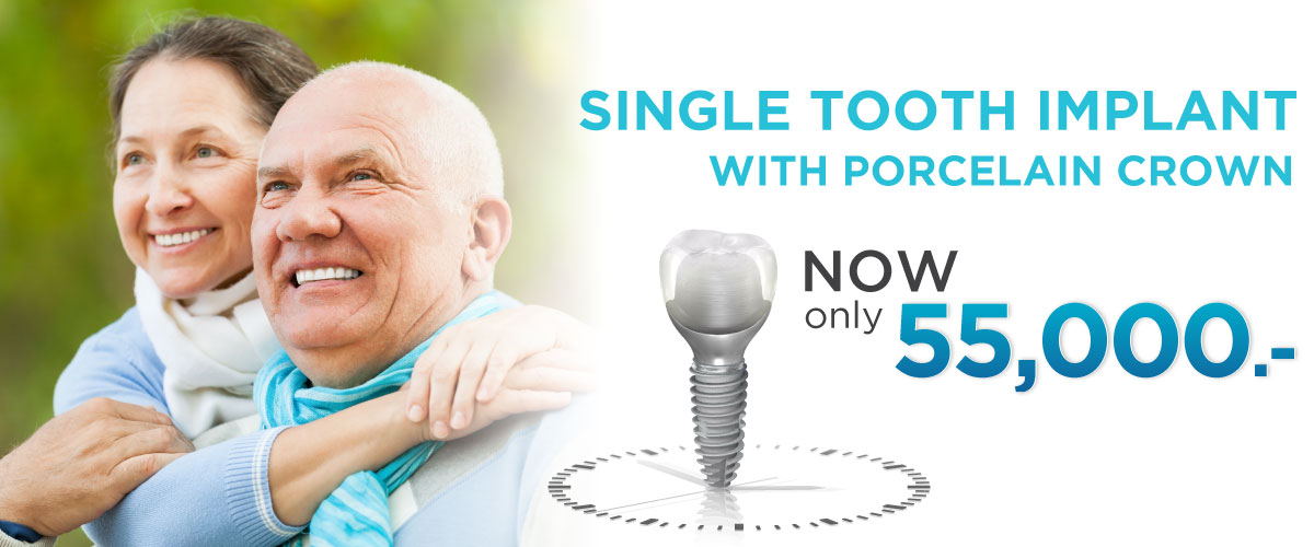 Dental Implants, Teeth Implants in Thailand Bangkok's Top Dental.