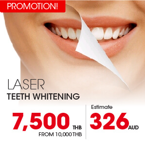 Laser tooth whitening