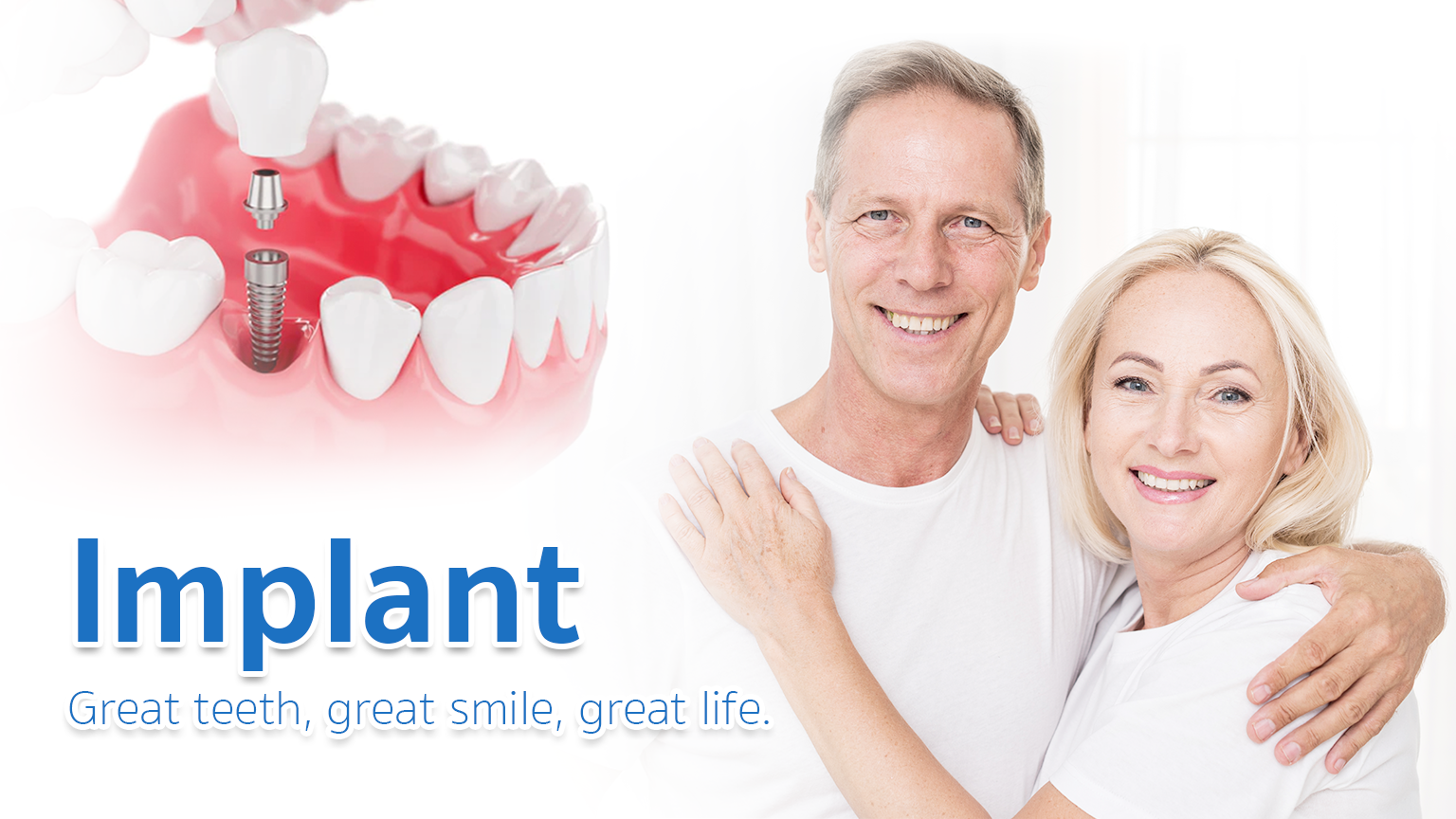 Review Implant Bangkok Dental Dentist Clinic By Bangkok Smile Dental 