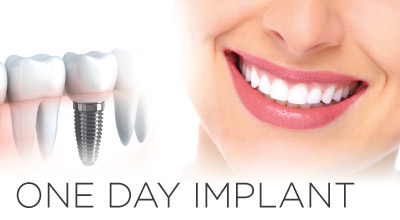 Oneday Implant