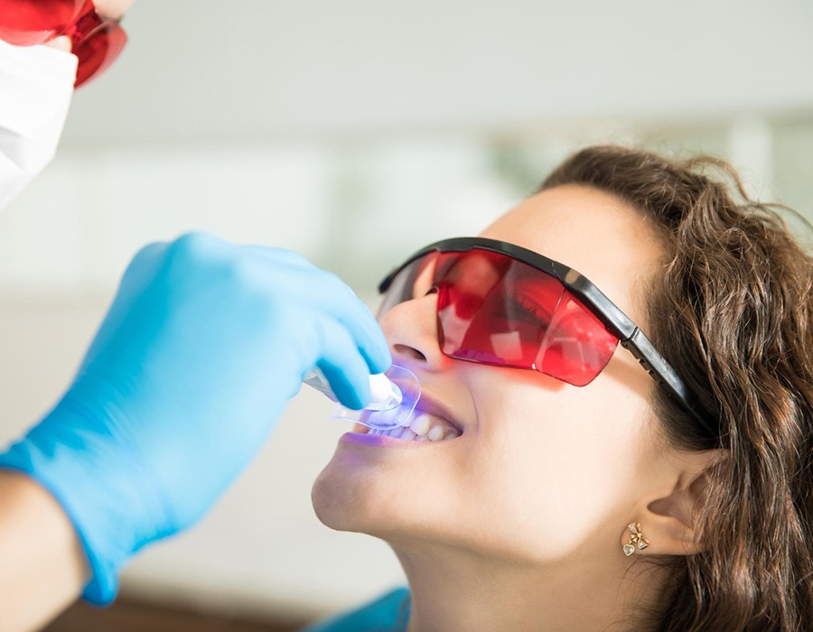laser Teeth Whitening