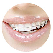 ศูนย์จัดฟัน Invisalign