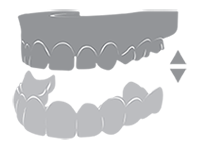 ครอบฟันขาวแบบถอดได้ (Snap on Smile)