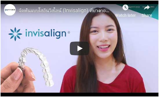 Invisalign