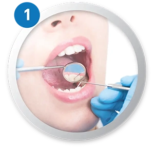 1. Teeth condition check up