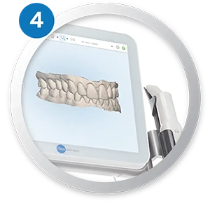 Creating the image of your intraoral with 3D software