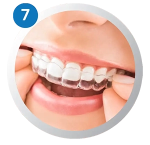 The aligner must be worn at least 22 Hrs. a day or as planned
