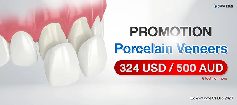 Thailand's Top Veneer Specialists