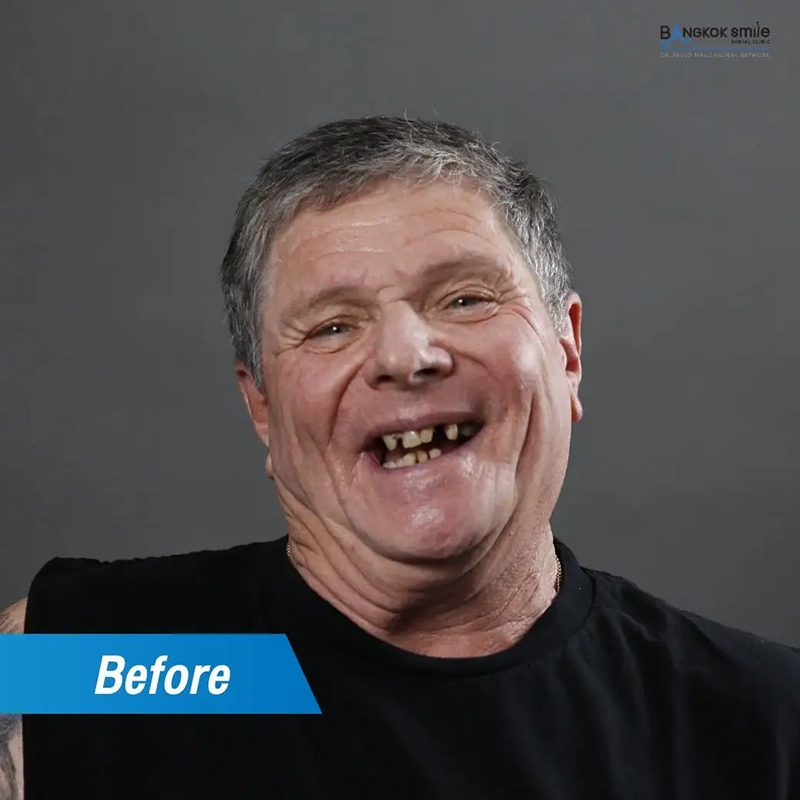 Patient Stories & Real-Life Transformations