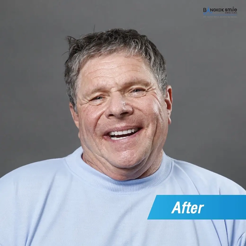 Patient Stories & Real-Life Transformations