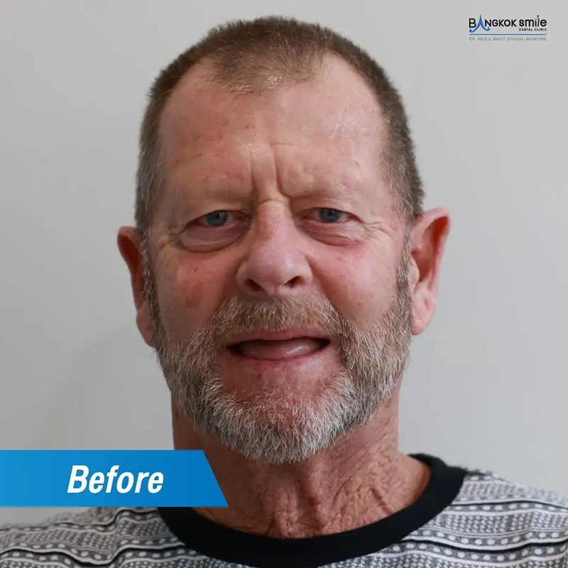 Patient Stories & Real-Life Transformations