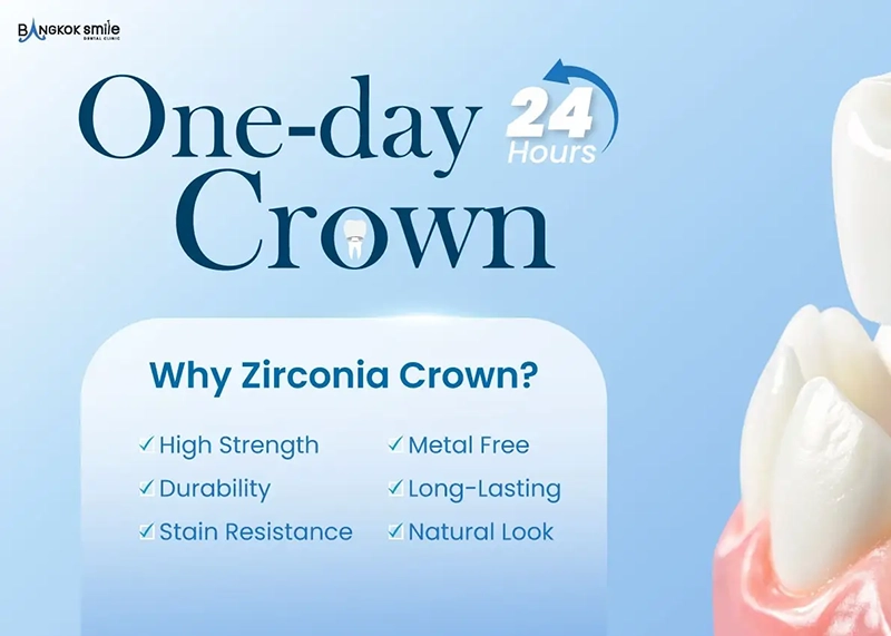 Dental Crowns and Dental Bridges