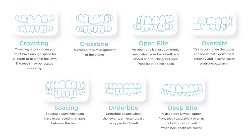 INVISALIGN™ can work for you!