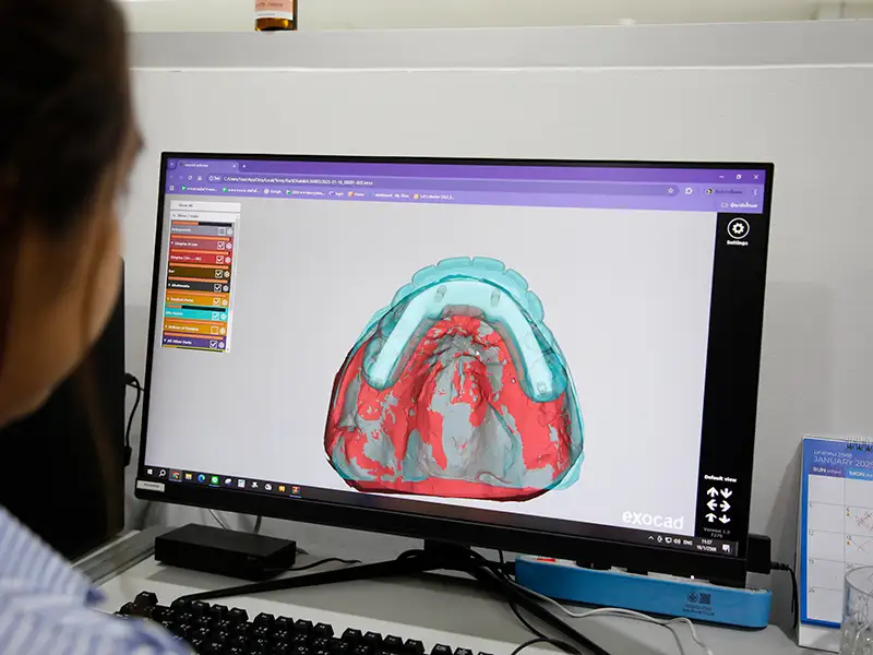 In-House Malo Dental Laboratory
