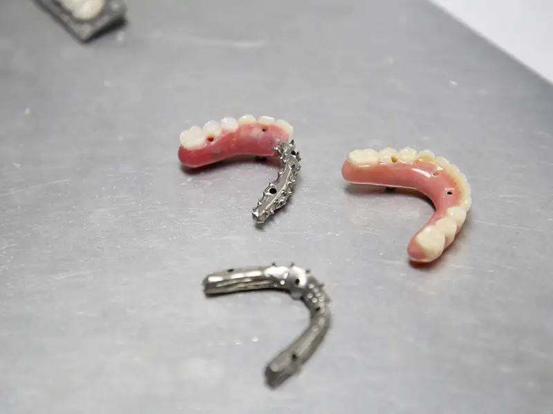 In-House Malo Dental Laboratory