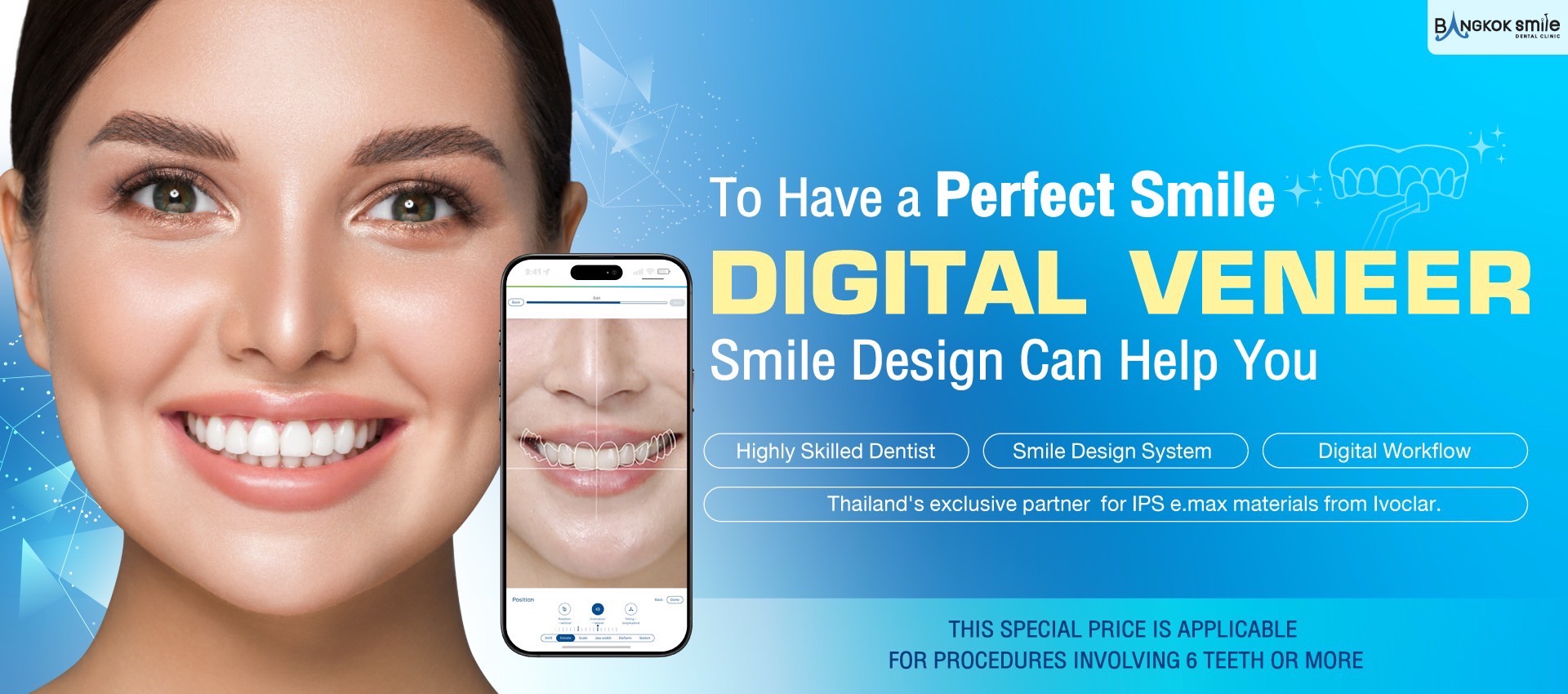 Digital Veneers
