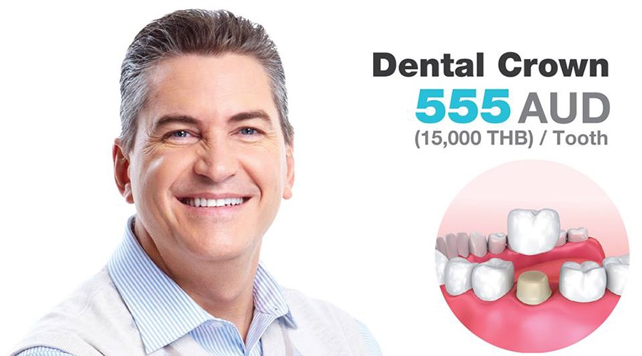 Dental Crowns. The secret to a beautiful and a sexy smile!!