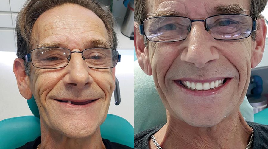 #1DayChallenge @Bangkok Smile MALO CLINIC