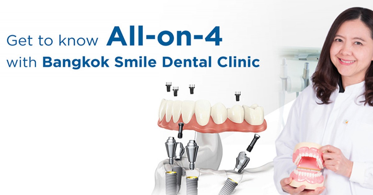 get to know more about all-on-4 , the best way to replace your missing teeth.