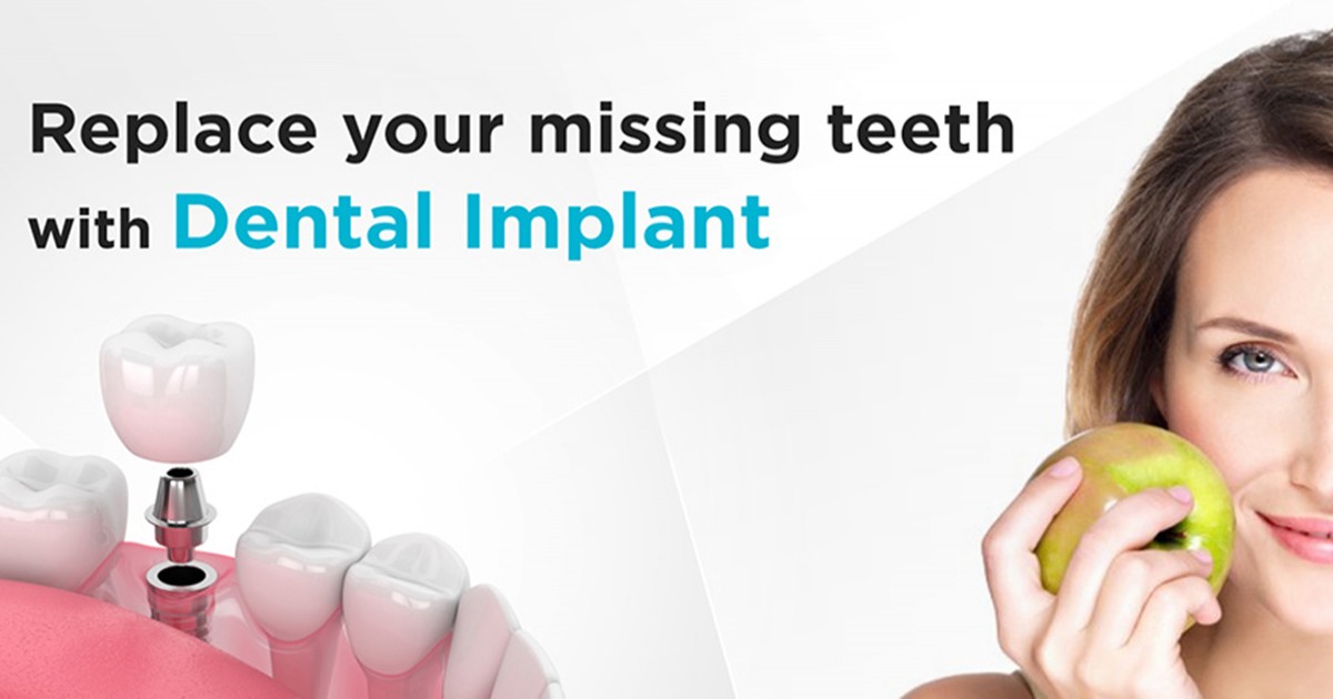 missing teeth? fix them with dental implant