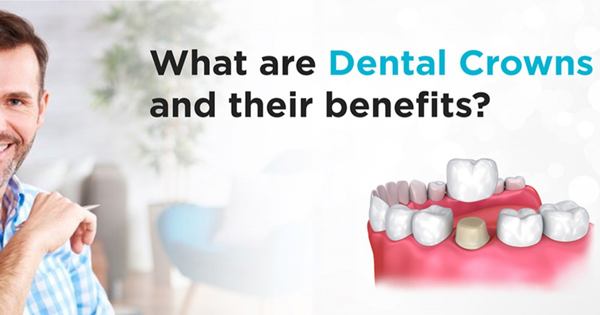 Things you need to know before wearing a (Dental) crown