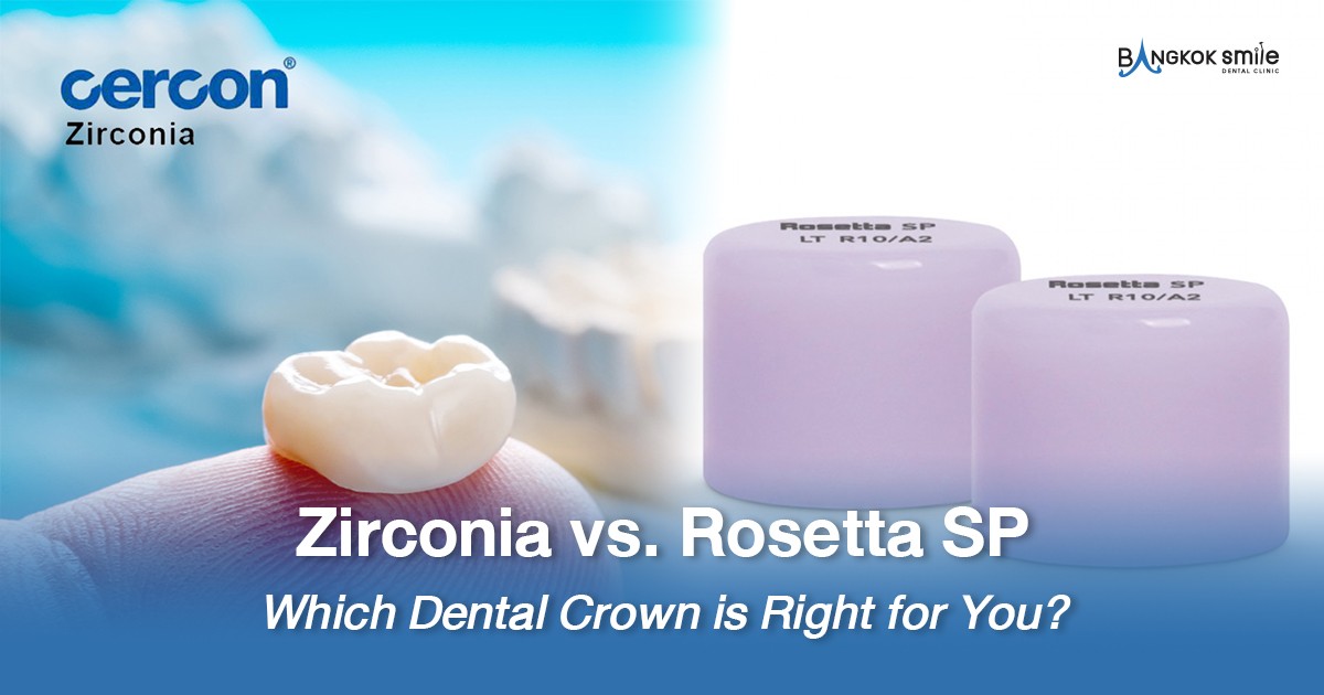 Zirconia vs. Rosetta SP: Which Dental Crown is Right for You?