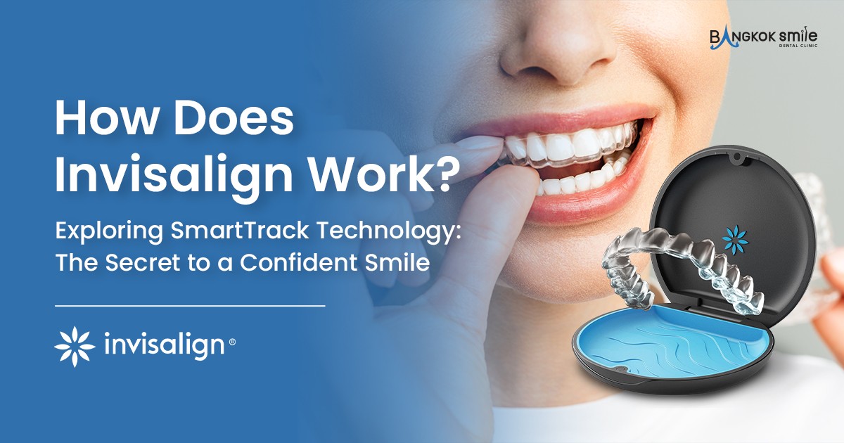 How Does Invisalign Work? Exploring SmartTrack Technology: The Secret to a Confident Smile