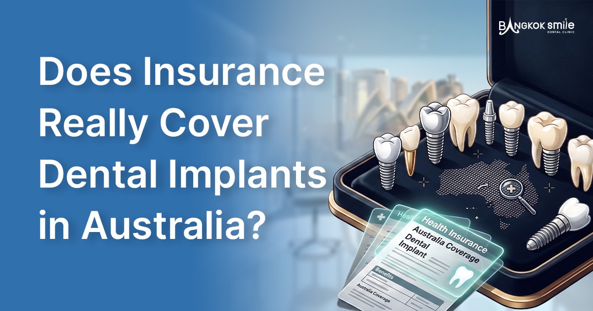 Does Medicare or Private Health Insurance Cover Dental Implants in Australia?