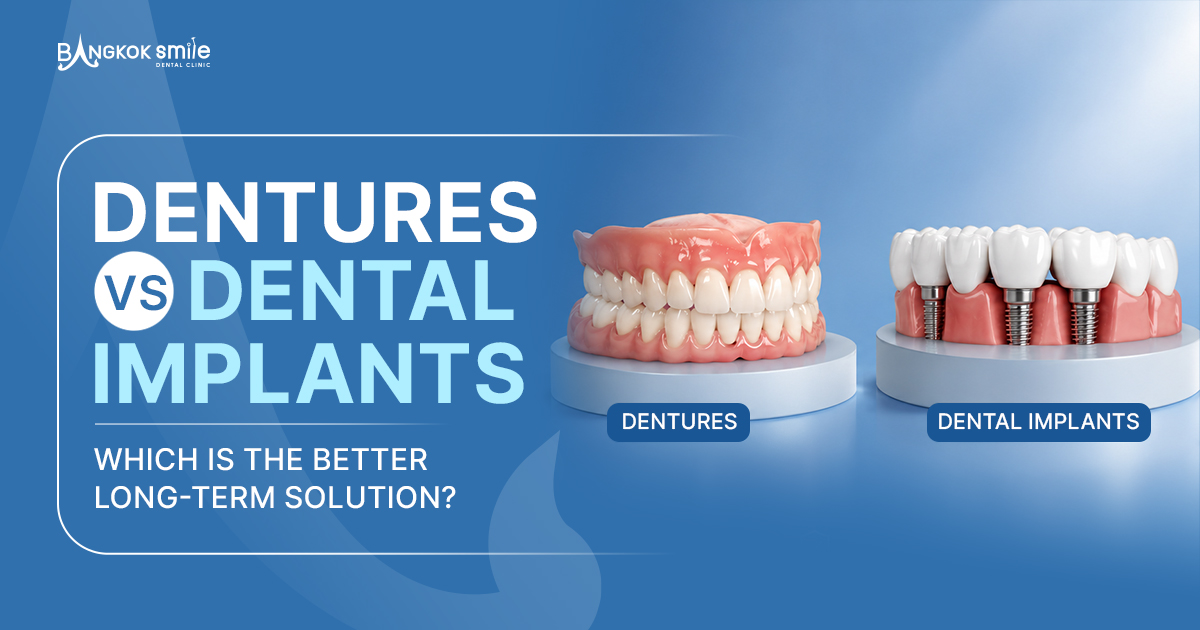 Dentures vs Dental Implants: Which Is Better for Long-Term Oral Health?