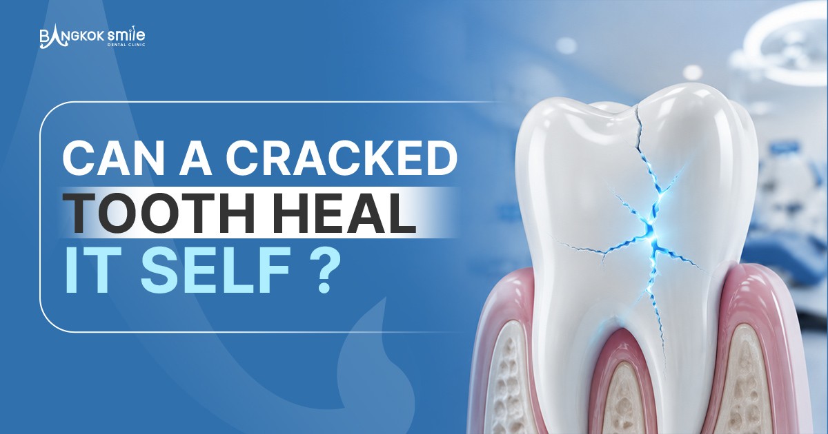  Can a Cracked Tooth Heal Itself?