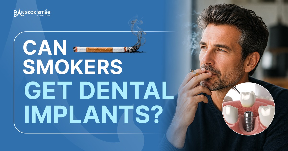 Can Smokers Get Dental Implants? 